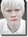 albino