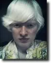 albino