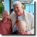 albino