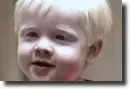 albino