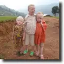 albino