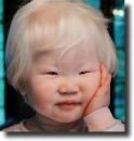 albino
