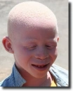 albino