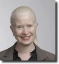 albino