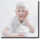 albino people