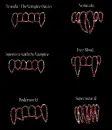 glittery vampire fangs