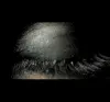 eye skull