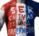 chivas es una enfermedad
