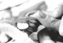 preemie baby hand