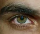 hazel eye