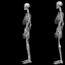 Kicking Skeletons
