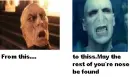 whooahh! where did ur nose go??