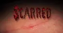 scarred