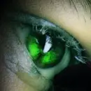 Green eye