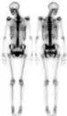 bones