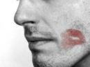 kiss