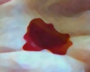 blood in palm 2