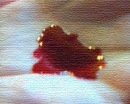blood in palm 4
