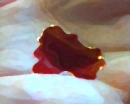 blood in palm 5