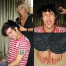 nasty look at his toes! oh well