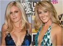 Heidi Montag, after and before plastic surgery