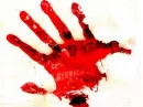 blood hand