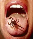 scorpion