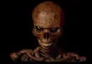skelly