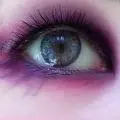 pink eye