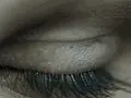 eye 