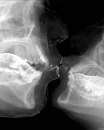 x-ray kiss