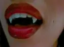 love bites