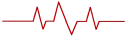 ECG wave