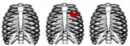 ribcage and a heart