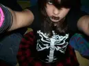 Emo ribcage