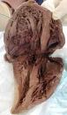 human heart