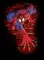 MatthewSpiderman